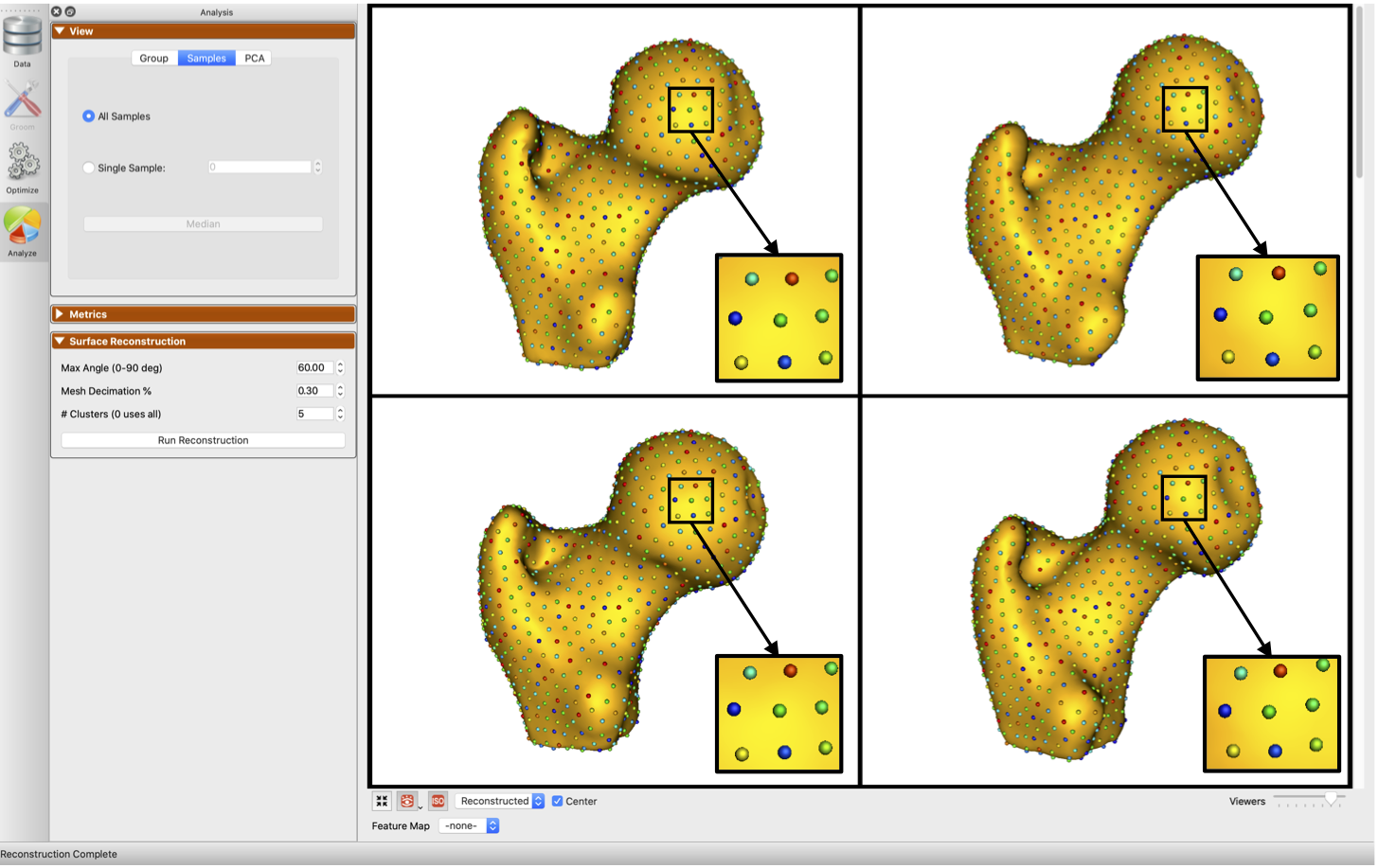 Template-deformation approach for surface reconstruction