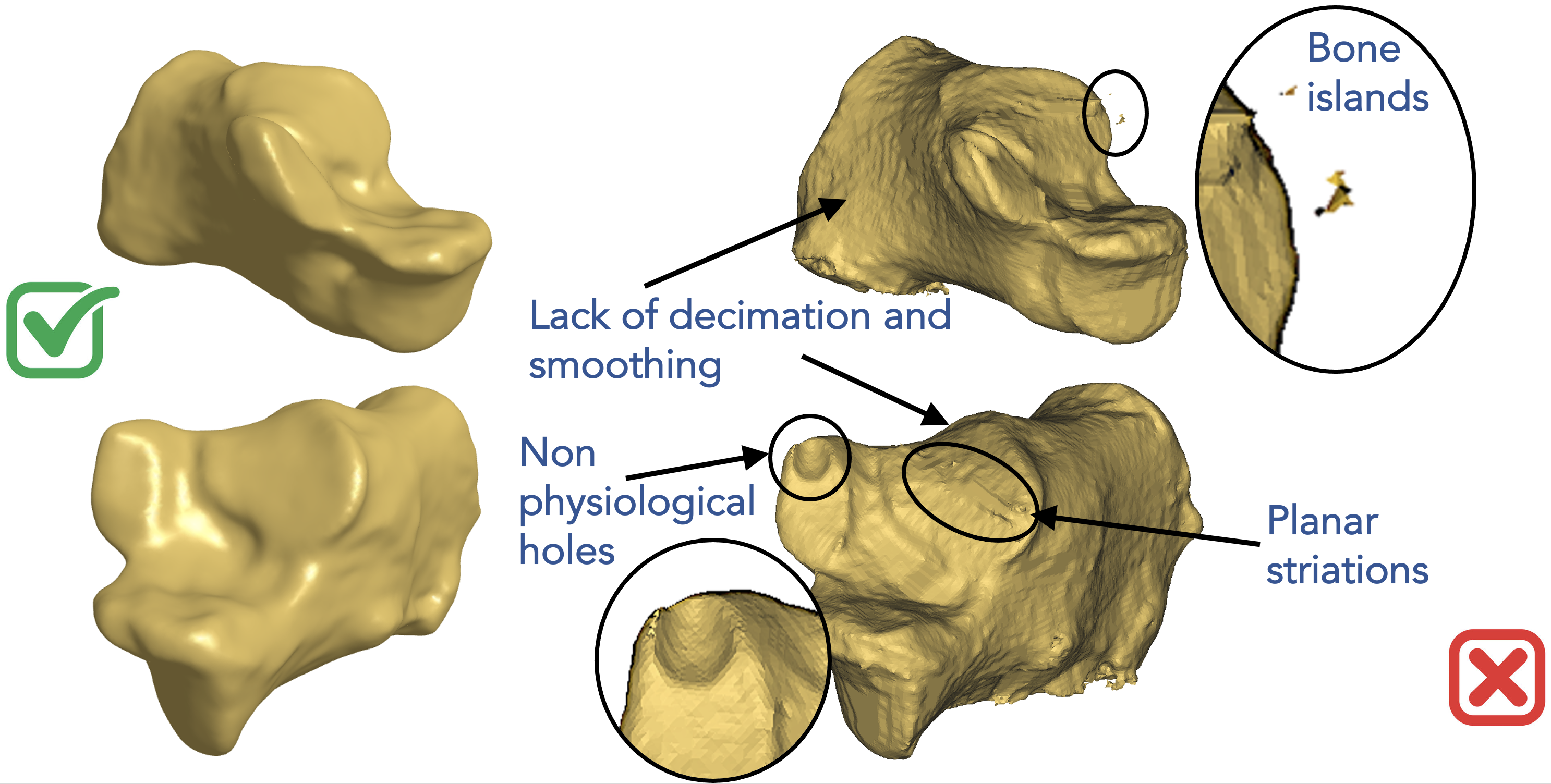 Ankle - good and bad surfaces