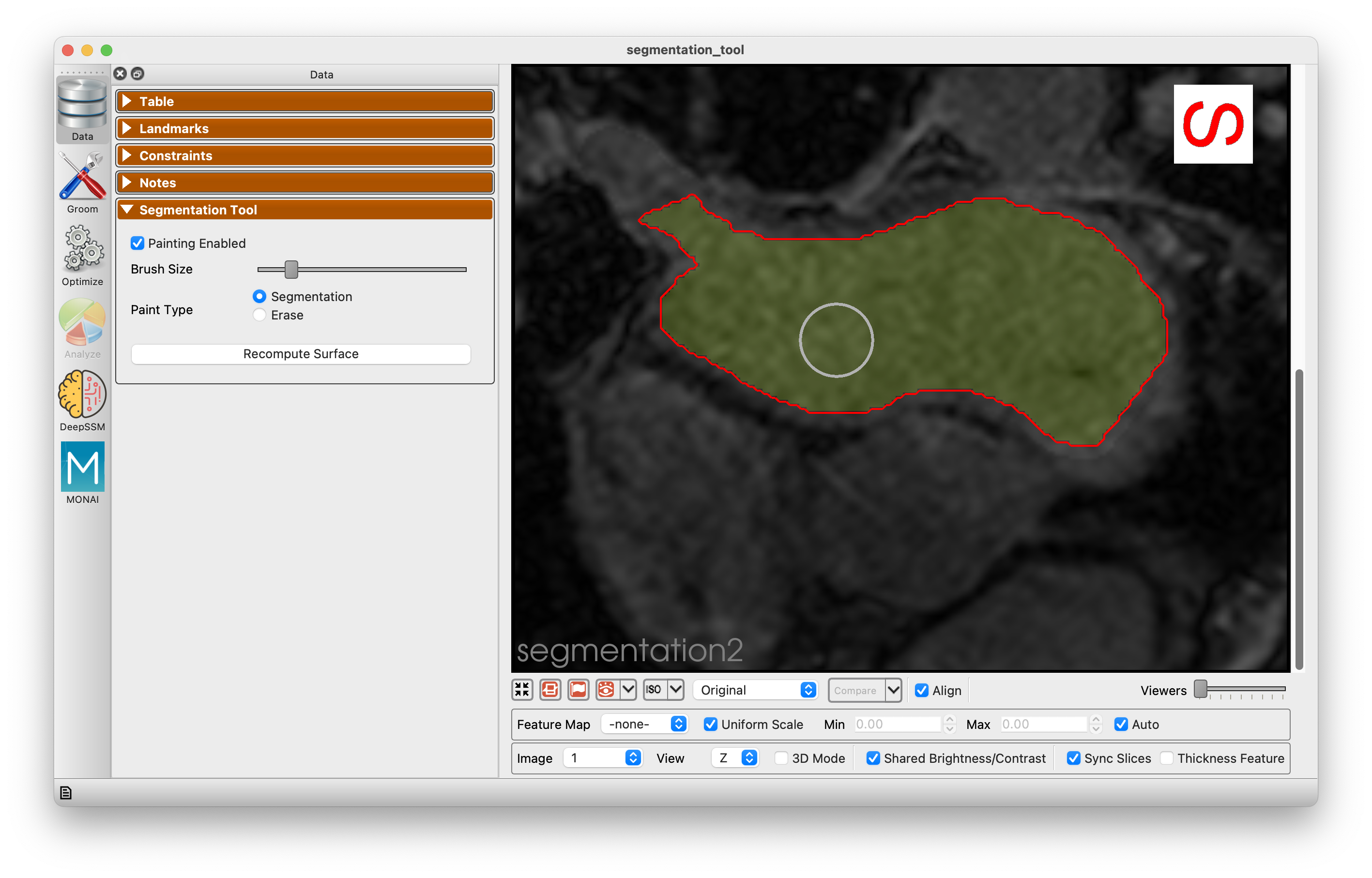 Segmentation Tool