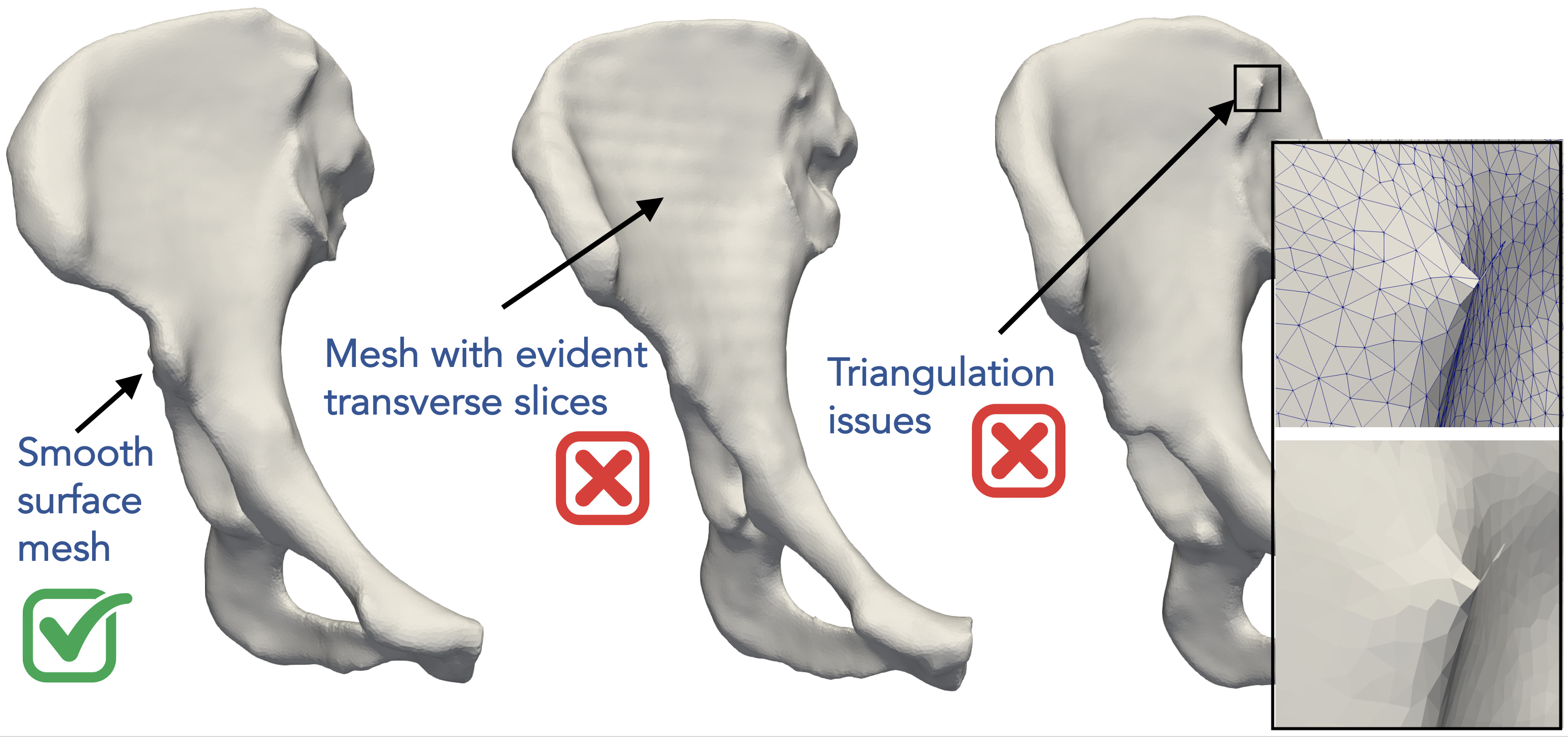 Hip - good and bad surfaces