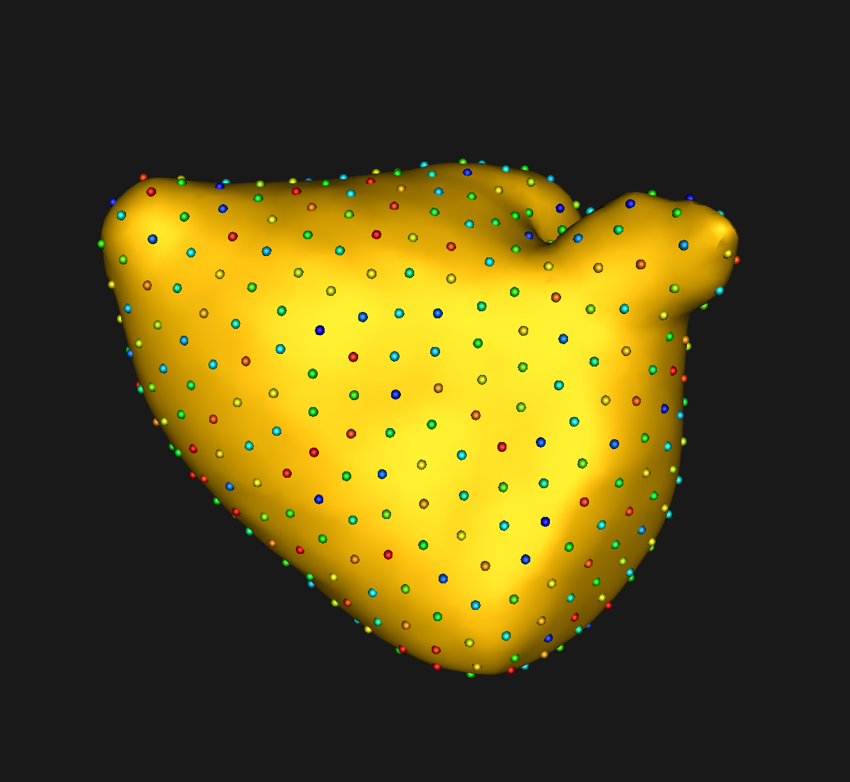 left Atrium singleScale