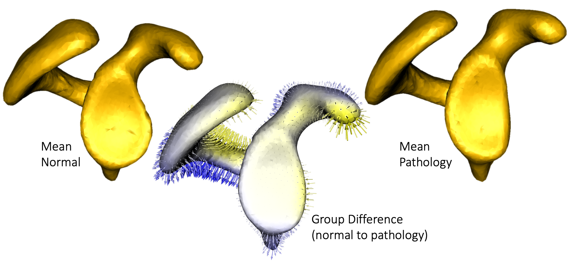 Template-deformation approach for surface reconstruction